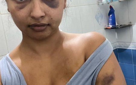 मलयालम एक्ट्रेस अनीका विक्रमन ने अपने ब्वॉयफ्रेंड पर शारीरिक शोषण का आरोप लगाया