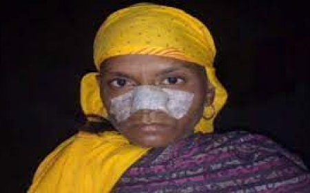 मुरैना में एक दामाद ने दांत से अपनी सास की नाक काट दी