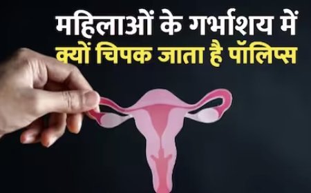महिलाओं के गर्भाशय में सालों पहले कुंडली मारकर बैठ जाता है पॉलिप, कैंसर और इनफर्टिलिटी का खतरा
