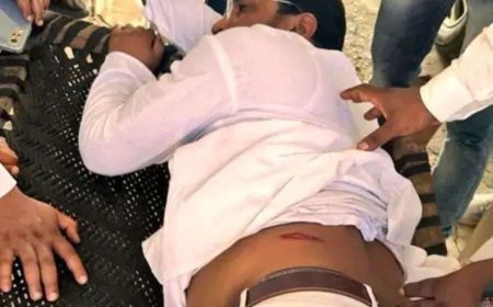 देवबंद में दलित नेता चंद्रशेखर आजाद पर जानलेवा हमला, कार सवार बदमाशों ने की फायरिंग